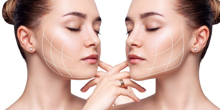 Facial liposuction