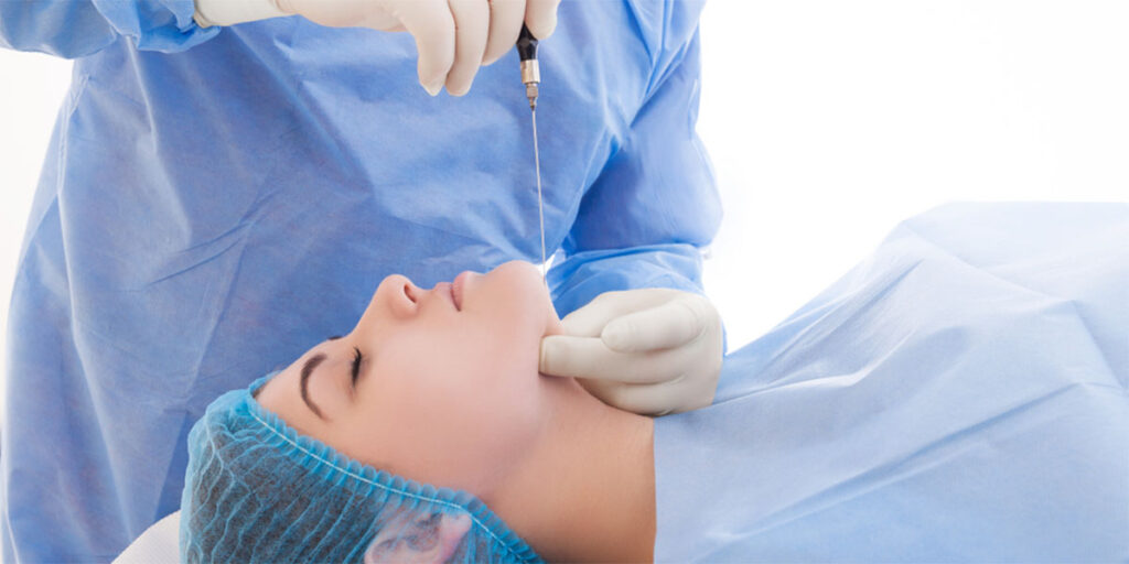 Facial liposuction procedure.