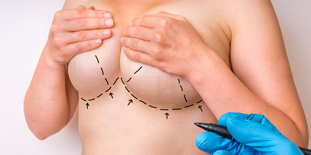 Breast liposuction