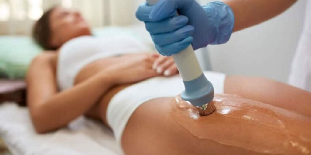 Cellulite treatment