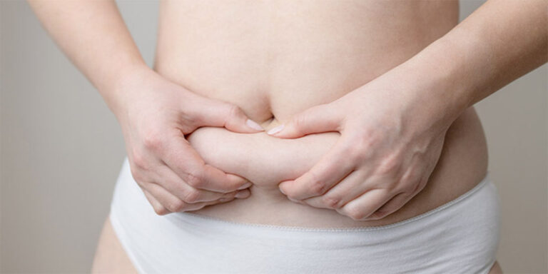 does fat come back after liposuction?