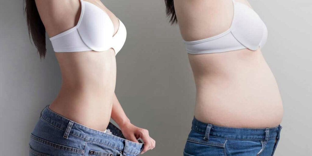 Benefits of Liposuction