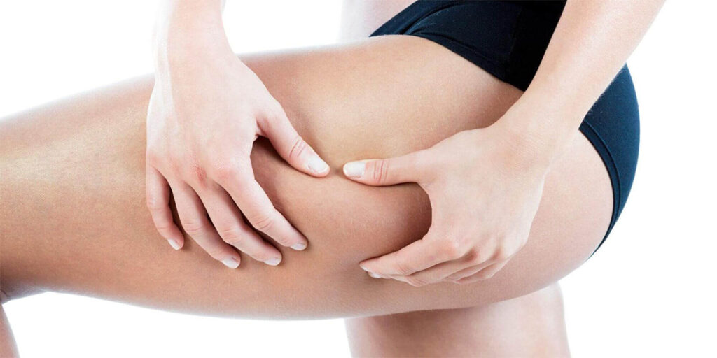 Thigh Liposuction vs. Thigh Lift