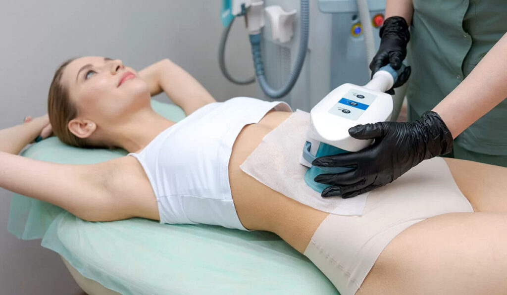 A woman undergoing cryolipolysis treatment.