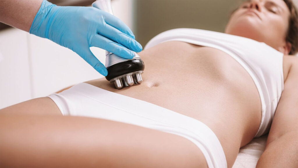 Radiofrequency for fat loss